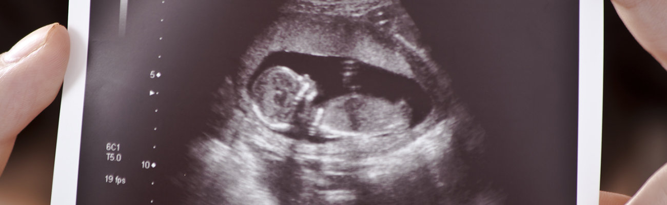 Woman holding ultrasound picture of her baby
